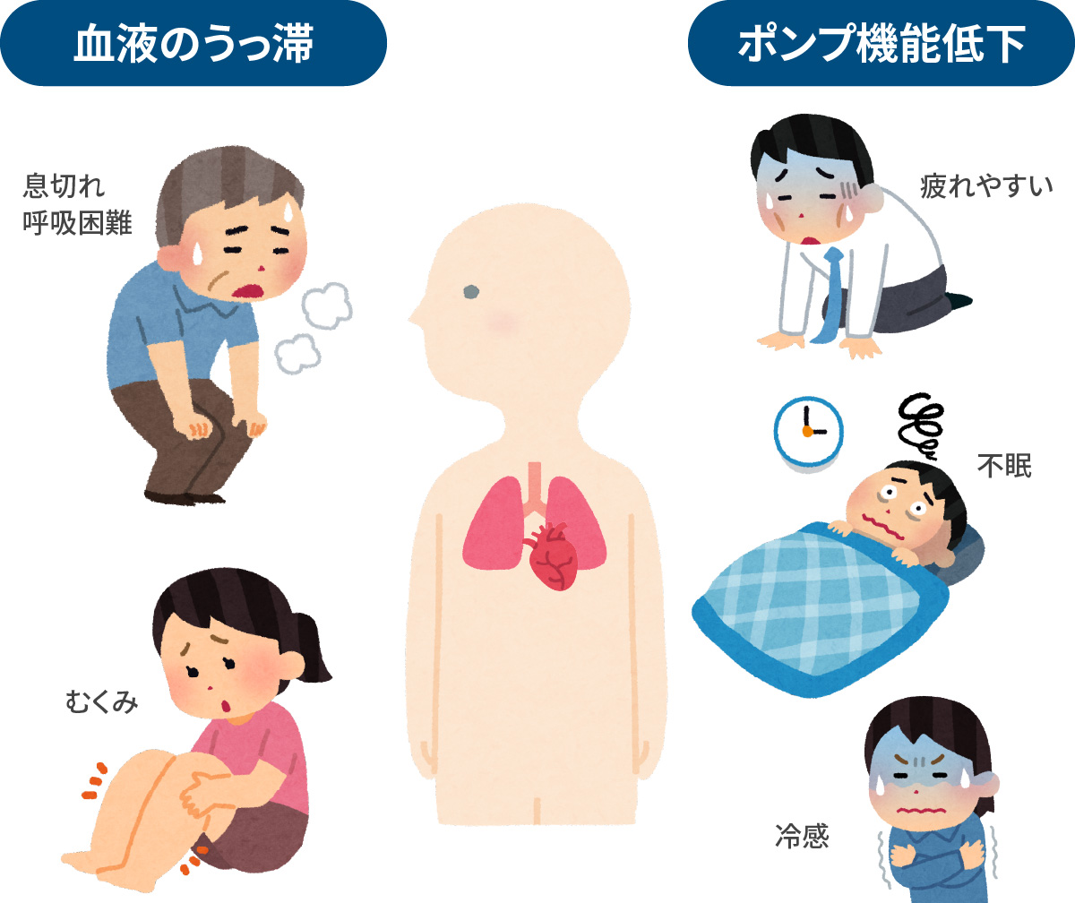 心不全とはなにか
