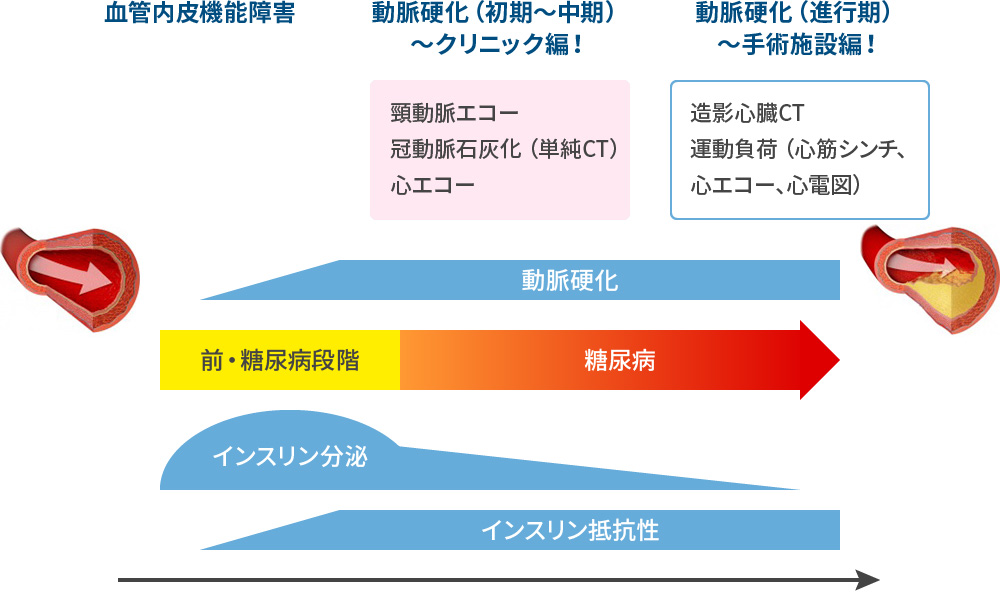 狭心症を早期に、外来で如何に見つけるか？
