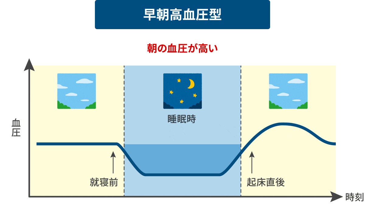 早朝高血圧型