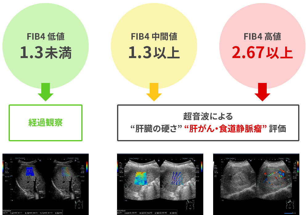 NAFLD/NASH