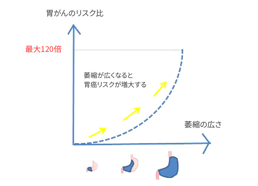 胃がんのリスク比
