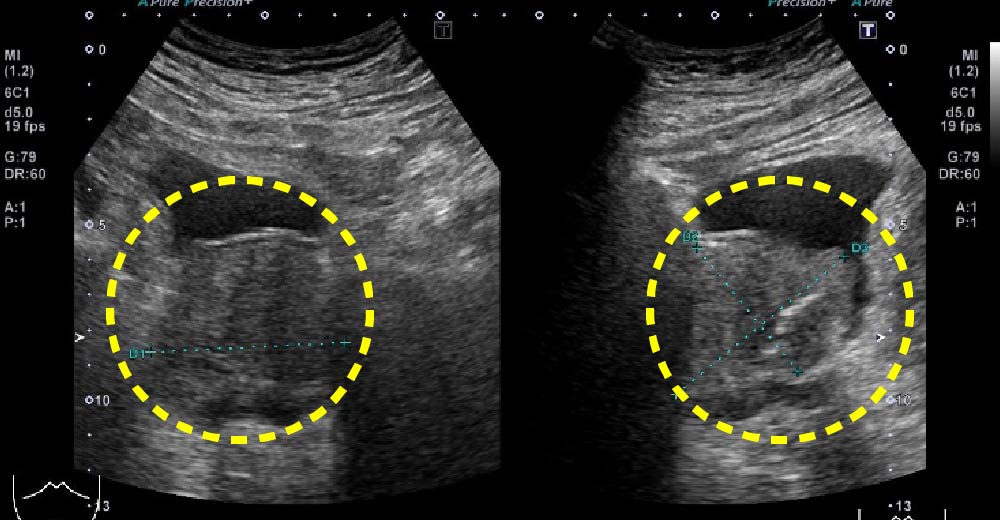 排尿に関わる２大疾患